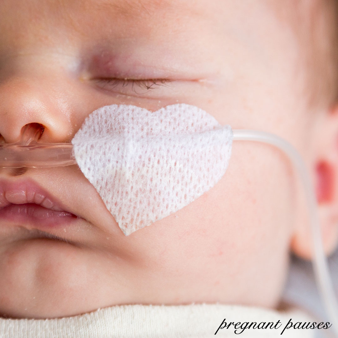 chest retractions in babies, when to get help